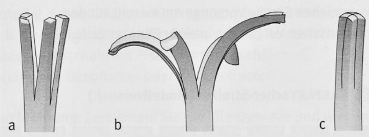 Drei schematische graustufige Darstellungen verzweigter Strukturen, beschriftet mit a, b und c.